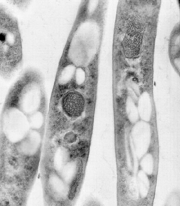 This transmission electron microscopic (TEM) image reveals some of the ultrastructural exhibited by a number of Bacillus anthracis bacteria. Note that these bacteria were cut in their longitudinal plane, reflecting their rod-shaped structure.